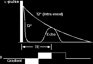 Fig.1 Questo importante metodo di imaging, viene chiamato Field Echo.