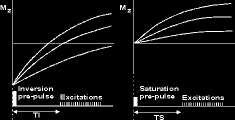 Fig.2: Tipi di preimpulsi utilizzati nelle sequenze TFE. I preimpulsi utilizzati nelle sequenze TFE possono essere di due tipi per la pesatura in T1. Impulso di Inversione a 180.