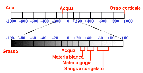 µ(hu) = si evince quindi che i tessuti molli, con attenuazione simile a quella dell acqua, sono caratterizzati da numeri di Hounsfield attorno allo zero, tessuti come l osso compatto hanno un valore