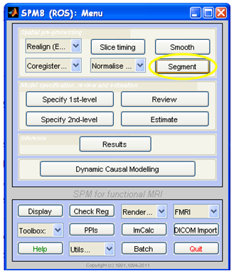 48 3.4 Funzione Segment di SPM8 La funzione Segment è una delle due funzioni implementate nel software SPM8 che esegue la segmentazione automatica delle immagini mediche.