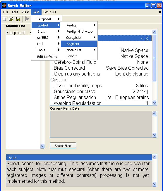 CAPITOLO 3: Segmentazione con SPM 49 Fig. 3.8: La funzione Segment può essere selezionata dal menu a tendina della finestra Batch Editor, tra le funzioni per il elaborazione spaziale.