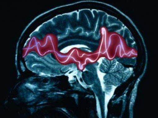 Epilessia: aspetti prognostici e clinico-assistenziali nelle epilessie 26 ottobre