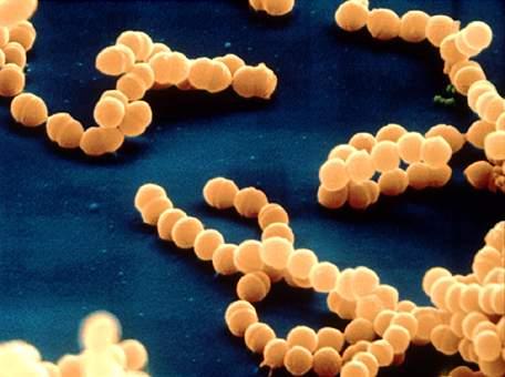 Streptococcus Pneumoniae