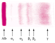 Preparazione gel d agarosio Posizionamento del gel nella camera elettroforetica Aggiunta del tampone elettroforetico Caricamento del campione Loading dye aiuta il caricamento del campione nel