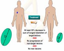 Response Evaluation Criteria in Solid Tumors (RECIST) RISPOSTA COMPLETA (CR) RISPOSTA PARZIALE (PR) Scomparsa completa di tutte le lesioni target e non target; assenza di nuove lesioni MALATTIA