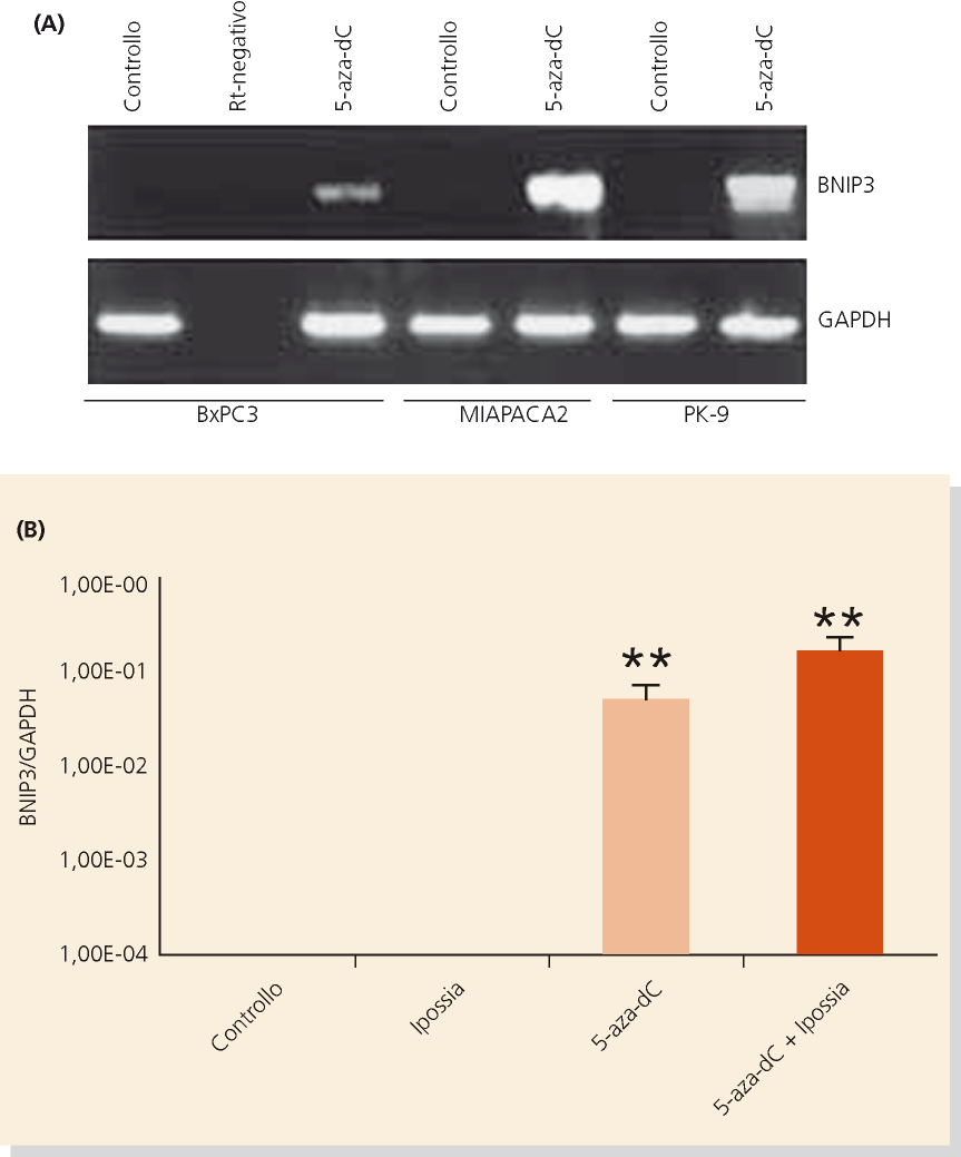 Induzione dell espresssione del gene BNIP3 (BCL2/adenovirus