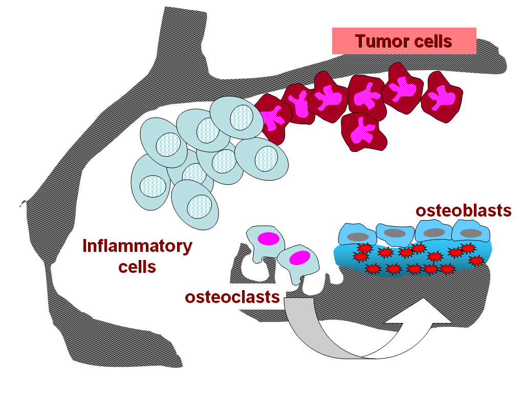 Terapia con RF osteotropi Trattamento simultaneo di più siti Facilità di somministrazione Ripetibilità Basso costo Buona efficacia palliativa Bassa tossicità