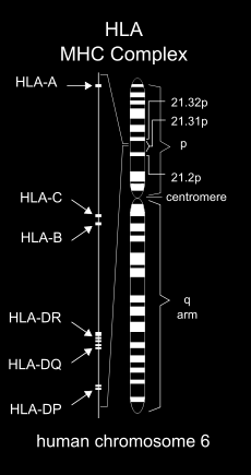 Più del 90 % dei pazienti con malattia celiaca presenta una variazione del HLA DQ2 e molti anche del gene HLA - DQ8.