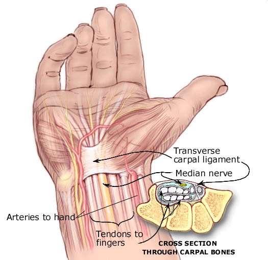 Sindrome del tunnel carpale La Sindrome del Tunnel Carpale (STC) è la neuropatia più frequente ed è dovuta alla compressione del nervo mediano al polso nel suo passaggio attraverso il tunnel carpale.