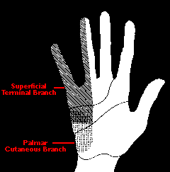 Clinica Nella sindrome del canale di Guyon, spesso la sensibilità sul dorso della mano e delle dita è normale.