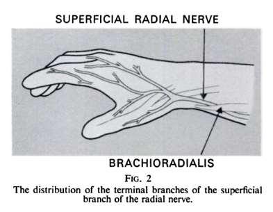 S. Radiale superficiale Superficial radial: Pain & sensory loss Elbow: Ruptured synovial effusion Forearm: