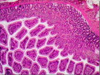 5. MICROBIOTA INTESTINALE E SISTEMA IMMUNITARIO L intestino è il più importante organo immunitario, contiene infatti circa il 40% di tutte le cellule immunitarie del corpo umano ed è il luogo di