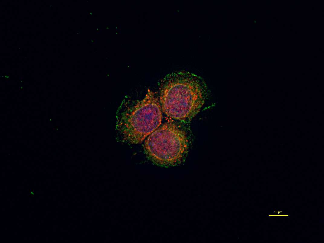 Enza 5 µm Enza 5 µm DAPI PKC-βII PKC-δ Merge BON1 1 PNN 1 FIGURA 26: Effetti di Enzastaurin sulla localizzazione di PKCβII e PKCδ in cellule BON1 ed in colture primarie di PETs.