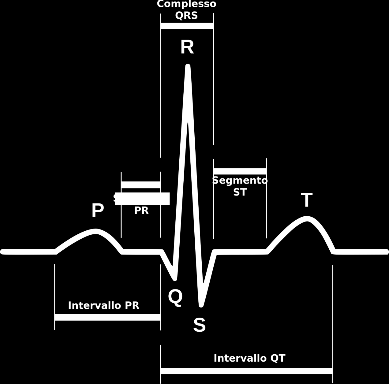 L elettrocardiogramma Gli standard dell ecg: deflessioni 60-120 Valori