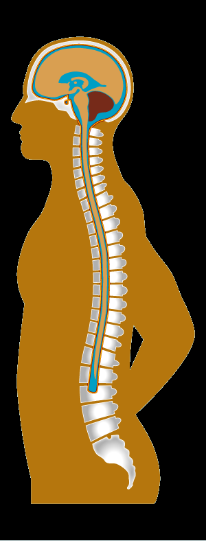 Quali sono le cause di Chiari? Problemi del fluido cerebrospinale Le alterazioni nella dinamica del flusso cerebrospinale spingono il cervelletto verso il basso.