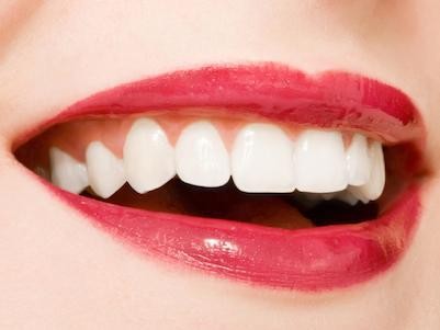 SERVICE EASYFOR white teeth and beautiful smile immediately Solo se sorridi scoprirai che vale ancora la pena vivere C.