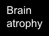 Current model s-cvd Lacunes WMH Hip scl Brain atrophy Executive imp. Memory imp.