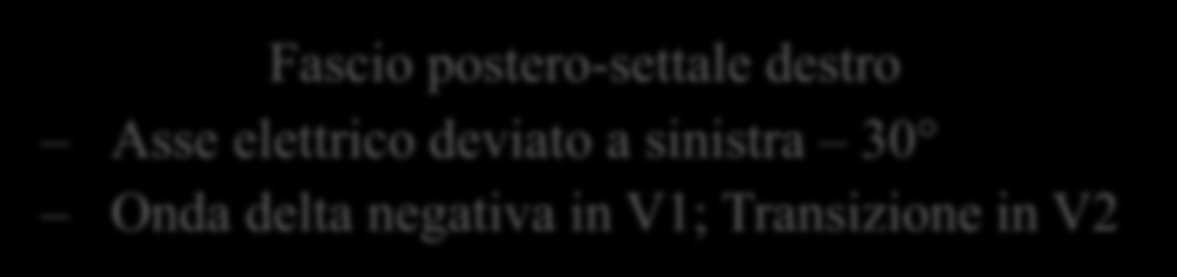 Fascio postero-settale destro Asse elettrico deviato a sinistra 30 Onda delta