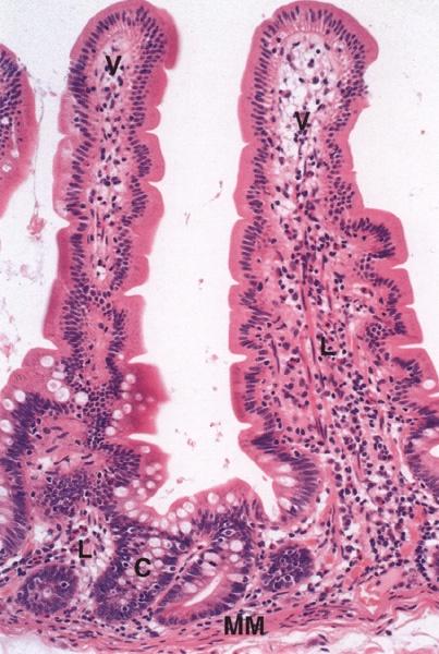 Estroflessioni digitiformi, Epitelio colonnare semplice Cellule chiare sono Caliciformi Ghiandole unicellulari Aumentano