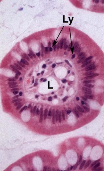 Protrusione della lamina propria Vaso chilifero e linfatico ciechi Ansa capillare Fibre di muscolo liscio