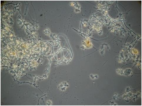 L analisi microscopica del fiocco di fango Agosto 2013: INFLUENTE ph ACIDO