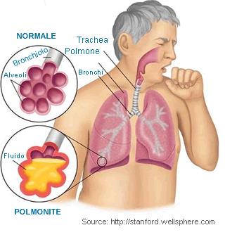 IGIENE AMBIENTALE infezioni nosocomiali Legionella Sono batteri mobili, che si trovano in natura nell acqua di fiumi e laghi e che nei sistemi di acqua condottata possono trovare l habitat ideale per