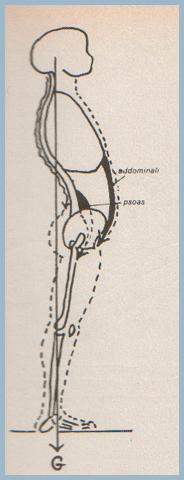 I vizi di portamento Portamento rilassato È un difetto del portamento dovuto a eccessiva lassità legamentosa e ipotonia muscolare Paramorfismo Quando il vizio di portamento può essere