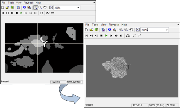 Approccio alla segmentazione della neoplasia Import in ambiente Matlab alcuna label ad un pixel, l elemento corrispondente della matrice assume valore 0.