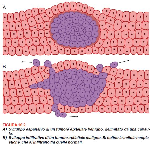 Tumori benigni Le cellule conservano un buon grado di differenziazione morfologica e funzionale, pur mostrando di non rispondere ai meccanismi di controllo della proliferazione cellulare.