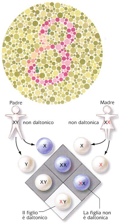 Le malattie genetiche Cecità al rosso e al verde (daltonismo) malattia recessiva legata al cromosoma X Test per la cecità al rosso (figura in alto) Chi non riesce a vedere il numero nel cerchio è