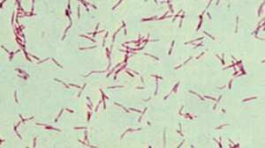 Legionella : Morfologia e struttura Famiglia: Legionellaceae Genere: Legionella