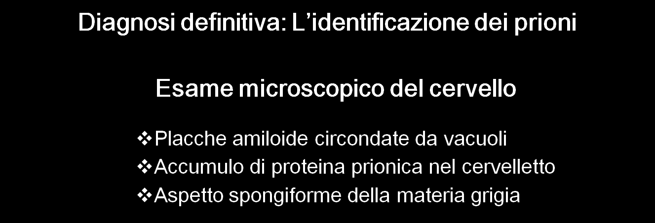 PRIONI: DIAGNOSI vcjd Ante-mortem Biopsia tonsillare positiva presenza della proteina