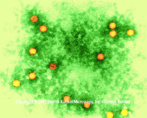 Virus della Poliomielite (PICORNAVIRUS)