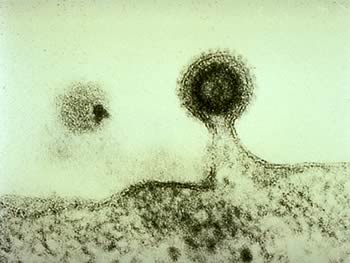 5) RILASCIO DELLE PARTICELLE VIRALI E' la tappa conclusiva del ciclo replicativo.