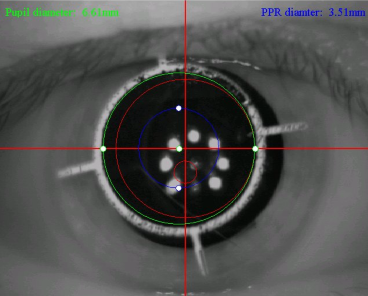 Problemi da risolvere Linea visiva rispetto asse visivo Centratura lenti Cornea Pupilla Adattamento del sistema visivo Centro della Pupilla (Linea visone) Centro della Cornea Asse Visivo Metodi