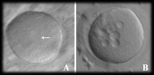 Markers morfologici della qualità ovocitaria Aggregati di reticolo endoplasmatico liscio ser clustering Il meccanismo di formazione è ancora sconosciuto Ebner, 2006 Sono facilmente distinguibili dai