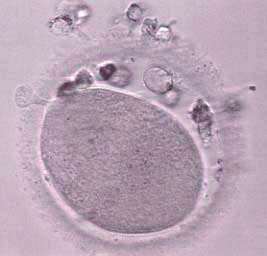 Markers morfologici della qualità ovocitaria Perivitelline space granularity La presenza di detriti nello spazio perivitelline influenza negativamente la fertilizzazione, il clivaggio embrionale e le