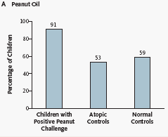 Lack G. Factors Associated with the Development of Peanut Allergy in Childhood. NEJM 2003-13.971 bambini seguiti longitudinalmente, - 23 allergici all arachide al test di provocazione. P 0.
