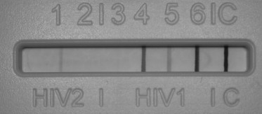 HIV 1-2 Ig totali (ELISA): Positivo Test di conferma HIV 1-2 IgG (Western blot): HIV-1 Positivo con banda indicativa di HIV-2 HIV-1 (tutte le bande)