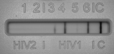 25/06/2015 HIV 1-2 Ag/Ab (CLIA): Positivo 6.