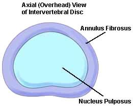 Il nucleo polposo ha la forma di una sfera interposta fra due piani: articolazione a snodo. Il disco intervertebrale è costituito prevalentemente d'acqua.