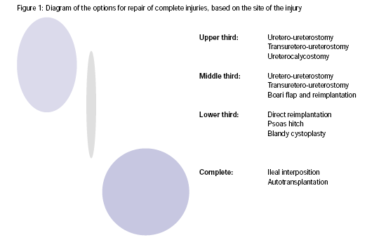 LESIONI URETERALI Le lesioni interessano