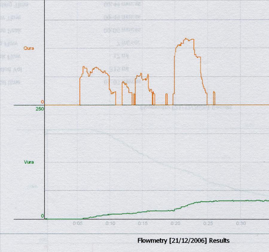 Flussometria : Forma della curva Interrupted flow - curve Minzione sostenuta