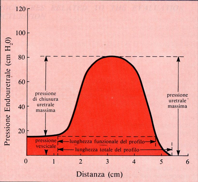 Profilo pressorio uretrale TERMINOLOGIA Pressione Uretrale massima = picco pressorio Lunghezza funzionale = lunghezza di uretra