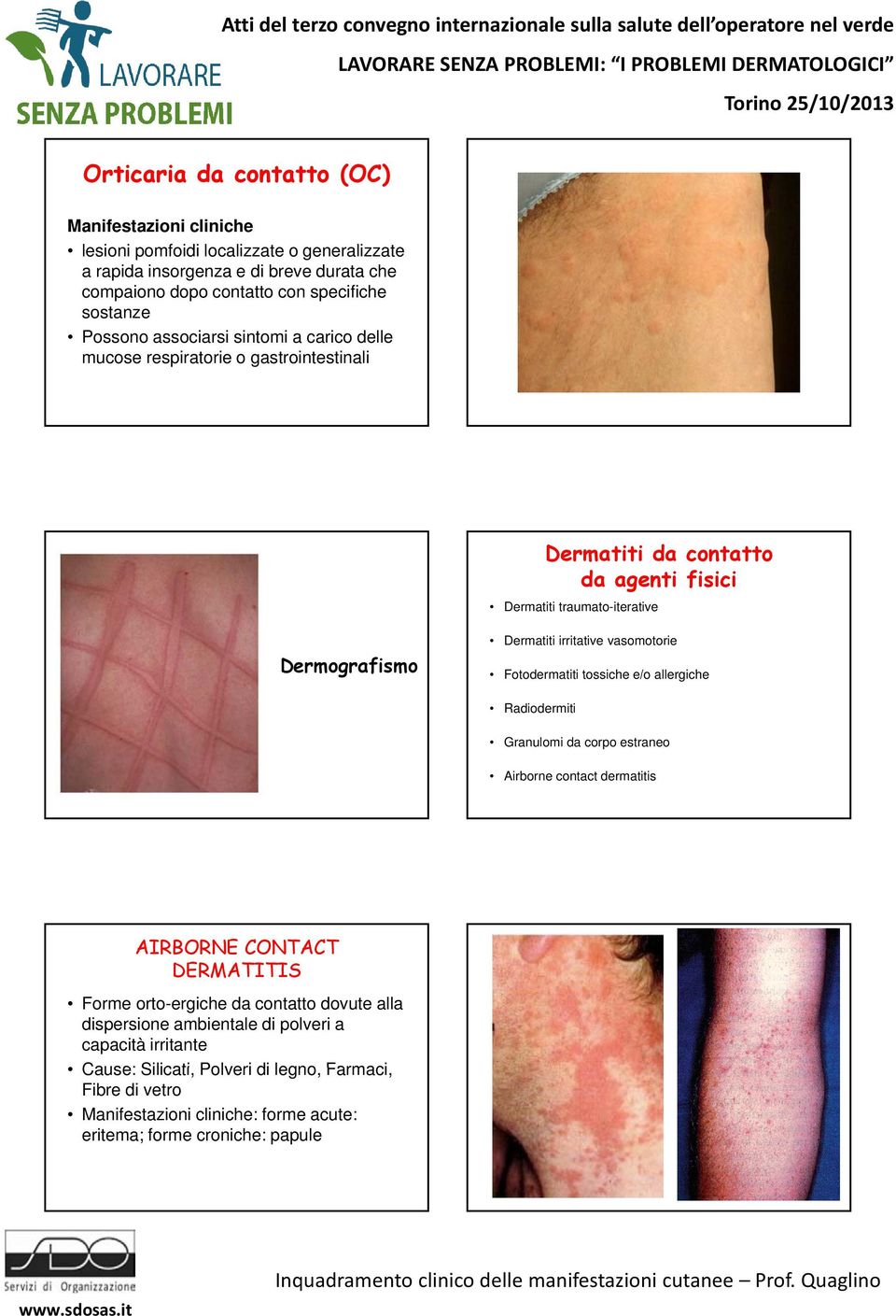 Fotodermatiti tossiche e/o allergiche Radiodermiti Granulomi da corpo estraneo Airborne contact dermatitis AIRBORNE CONTACT DERMATITIS Forme orto-ergiche da contatto dovute alla dispersione