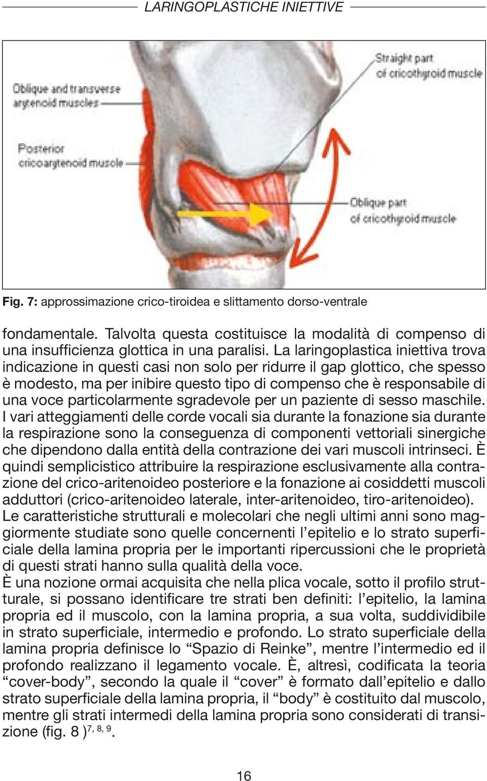 La laringoplastica iniettiva trova indicazione in questi casi non solo per ridurre il gap glottico, che spesso è modesto, ma per inibire questo tipo di compenso che è responsabile di una voce