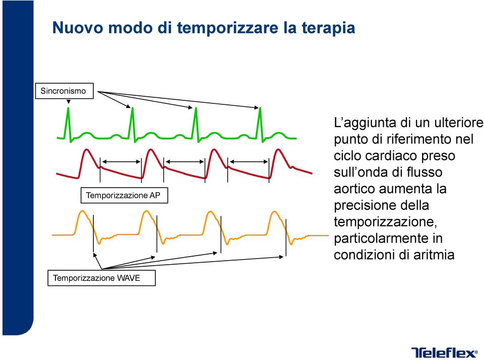 preso sull onda di flusso aortico aumenta la precisione della