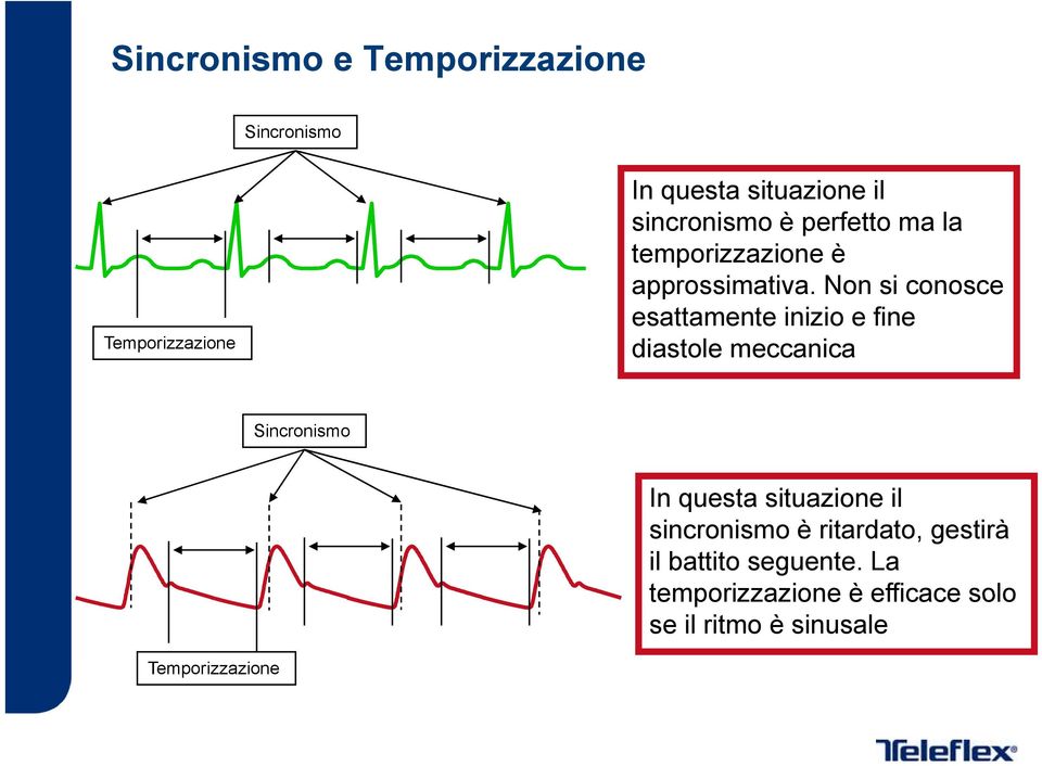 Non si conosce esattamente inizio e fine diastole meccanica Sincronismo In questa