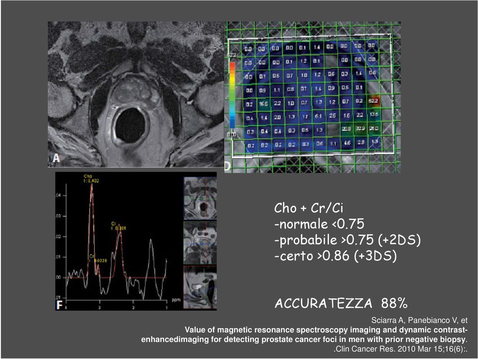 resonance spectroscopy imaging and dynamic contrastenhancedimaging for