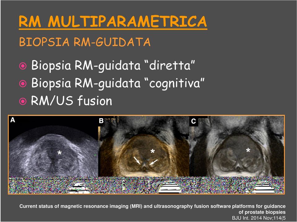 magnetic resonance imaging (MRI) and ultrasonography fusion